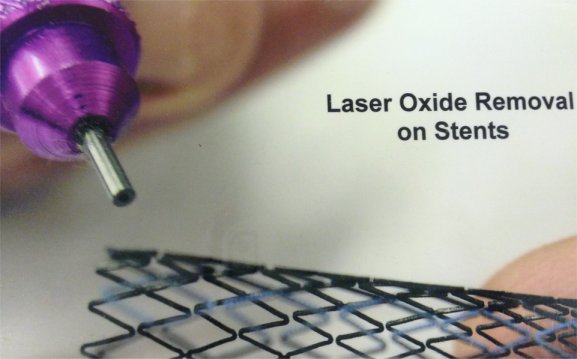 Oxide removal on stents